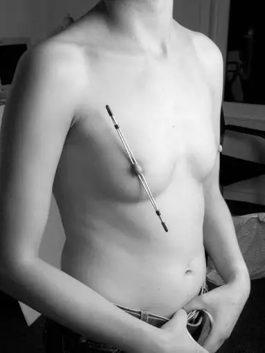 King Kink | Nipple Sticks 20cm | 1 Pc 3 King Kink | Nipple Sticks 20cm | 1 Pc